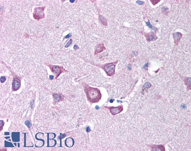 RPE65 Antibody - Anti-RPE65 antibody IHC of human brain cortex. Immunohistochemistry of formalin-fixed, paraffin-embedded tissue after heat-induced antigen retrieval. Antibody concentration 5 ug/ml.  This image was taken for the unconjugated form of this product. Other forms have not been tested.