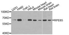 RPE65 Antibody - Western blot analysis of extracts of various cells.