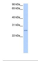 RPESP / C8orf84 Antibody - Jurkat cell lysate. Antibody concentration: 2.0 ug/ml. Gel concentration: 12%.  This image was taken for the unconjugated form of this product. Other forms have not been tested.