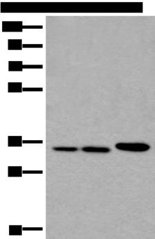 RPF2 / BXDC1 Antibody - Western blot analysis of A549 Hela and K562 cell lysates  using RPF2 Polyclonal Antibody at dilution of 1:400