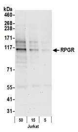 RPGR Antibody - Detection of human RPGR by western blot. Samples: Whole cell lysate (50, 15, 5 µg) from Jurkat cells prepared using NETN lysis buffer. Antibody: Affinity purified rabbit anti-RPGR antibody used for WB at 0.04 µg/ml. Detection: Chemiluminescence with an exposure time of 30 seconds.