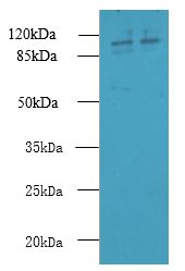 RPGR Antibody - Western blot. All lanes: RPGR antibody at 6 ug/ml. Lane 1: 293T whole cell lysate. Lane 2: HeLa whole cell lysate. Secondary Goat polyclonal to Rabbit IgG at 1:10000 dilution. Predicted band size: 113 kDa. Observed band size: 113 kDa.