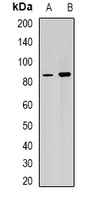 RPGR Antibody - Western blot analysis of RPGR expression in Y79 (A); mouse heart (B) whole cell lysates.