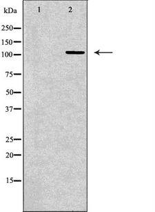 RPGR Antibody - Western blot analysis of mouse heart lysate using RPGR antibody. The lane on the left is treated with the antigen-specific peptide.