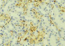 RPGR Antibody - 1:100 staining mouse liver tissue by IHC-P. The sample was formaldehyde fixed and a heat mediated antigen retrieval step in citrate buffer was performed. The sample was then blocked and incubated with the antibody for 1.5 hours at 22°C. An HRP conjugated goat anti-rabbit antibody was used as the secondary.