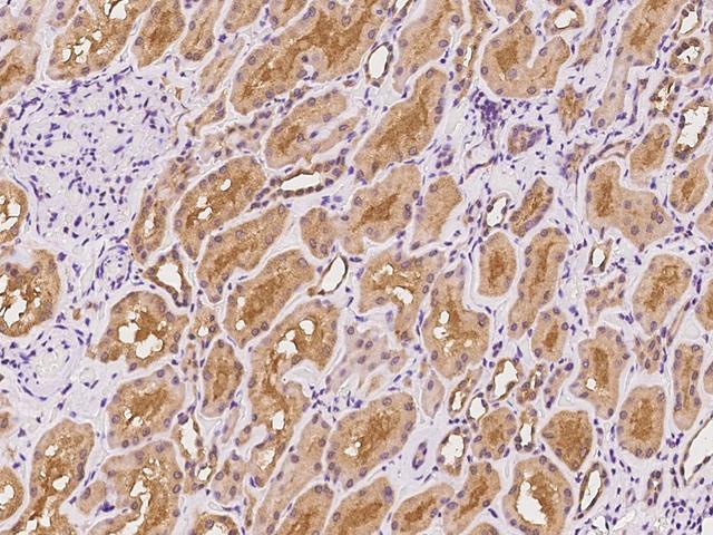 RPGR Antibody - Immunochemical staining of human RPGR in human kidney with rabbit polyclonal antibody at 1:100 dilution, formalin-fixed paraffin embedded sections.