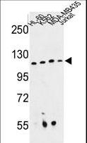 RPGRIP1 Antibody - Western blot of RPGRIP1 Antibody in HL-60, K562, MDA-MB435, Jurkat cell line lysates (35 ug/lane). RPGRIP1 (arrow) was detected using the purified antibody.