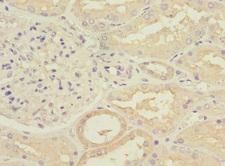 RPGRIP1 Antibody - Immunohistochemistry of paraffin-embedded human kidney tissue at dilution 1:100