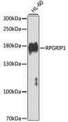 RPGRIP1 Antibody - Western blot analysis of extracts of HL-60 cells using RPGRIP1 Polyclonal Antibody at dilution of 1:1000.