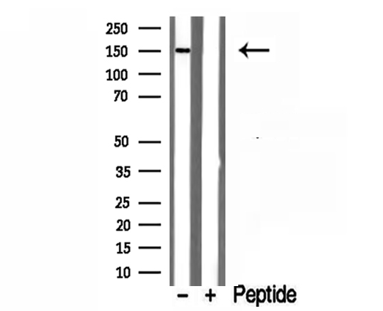 RPGRIP1L Antibody - Western blot analysis of extracts of human kidney tissue using RPGRIP1L antibody.