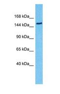 RPGRIP1L Antibody - Western blot of FTM Antibody with human 293T Whole Cell lysate.  This image was taken for the unconjugated form of this product. Other forms have not been tested.