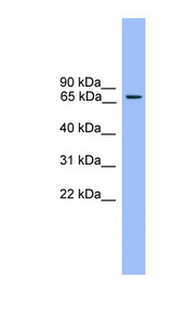 RPH3A / Rabphilin 3A Antibody - RPH3A / Rabphilin 3A antibody Western blot of Mouse Muscle lysate.  This image was taken for the unconjugated form of this product. Other forms have not been tested.