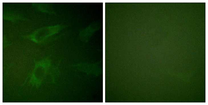 RPH3A / Rabphilin 3A Antibody - Immunofluorescence analysis of HeLa cells, using Rabphilin 3A Antibody. The picture on the right is blocked with the synthesized peptide.