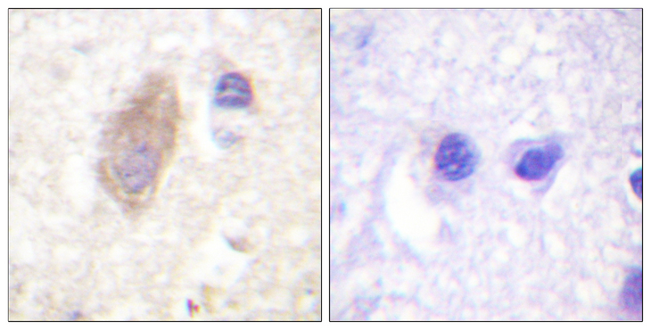 RPH3A / Rabphilin 3A Antibody - Immunohistochemistry analysis of paraffin-embedded human brain tissue, using Rabphilin 3A Antibody. The picture on the right is blocked with the synthesized peptide.