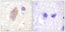 RPH3A / Rabphilin 3A Antibody - Immunohistochemistry analysis of paraffin-embedded human brain tissue, using Rabphilin 3A Antibody. The picture on the right is blocked with the synthesized peptide.