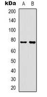 RPH3A / Rabphilin 3A Antibody - Western blot analysis of Rabphilin 3A expression in HeLa (A); mouse muscle (B) whole cell lysates.
