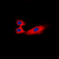 RPH3A / Rabphilin 3A Antibody - Immunofluorescent analysis of Rabphilin 3A staining in HeLa cells. Formalin-fixed cells were permeabilized with 0.1% Triton X-100 in TBS for 5-10 minutes and blocked with 3% BSA-PBS for 30 minutes at room temperature. Cells were probed with the primary antibody in 3% BSA-PBS and incubated overnight at 4 deg C in a humidified chamber. Cells were washed with PBST and incubated with a DyLight 594-conjugated secondary antibody (red) in PBS at room temperature in the dark. DAPI was used to stain the cell nuclei (blue).