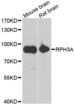 RPH3A / Rabphilin 3A Antibody - Western blot analysis of extracts of various cell lines, using RPH3A antibody.