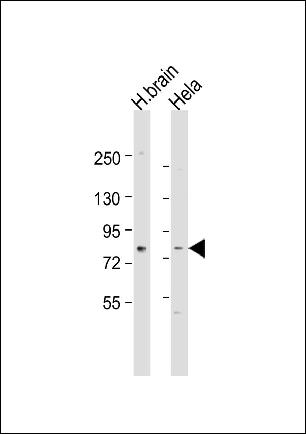RPH3A / Rabphilin 3A Antibody - All lanes: Anti-Rabphilin 3A Antibody at 1:1000 dilution. Lane 1: human brain lysate. Lane 2: HeLa whole cell lysate Lysates/proteins at 20 ug per lane. Secondary Goat Anti-Rabbit IgG, (H+L), Peroxidase conjugated at 1:10000 dilution. Predicted band size: 77 kDa. Blocking/Dilution buffer: 5% NFDM/TBST.