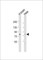 RPH3A / Rabphilin 3A Antibody - All lanes: Anti-Rabphilin 3A Antibody at 1:1000 dilution. Lane 1: human brain lysate. Lane 2: HeLa whole cell lysate Lysates/proteins at 20 ug per lane. Secondary Goat Anti-Rabbit IgG, (H+L), Peroxidase conjugated at 1:10000 dilution. Predicted band size: 77 kDa. Blocking/Dilution buffer: 5% NFDM/TBST.