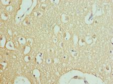 RPH3A / Rabphilin 3A Antibody - Immunohistochemistry of paraffin-embedded human brain tissue at dilution 1:100