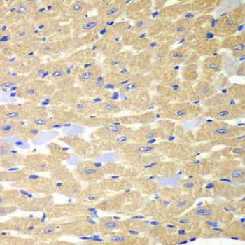 RPH3A / Rabphilin 3A Antibody - Immunohistochemistry of paraffin-embedded mouse heart using RPH3A antibody at dilution of 1:100 (40x lens).