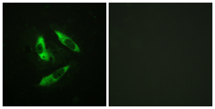 RPH3A / Rabphilin 3A Antibody - Immunofluorescence analysis of HeLa cells, using Rabphilin 3A (Phospho-Ser237) Antibody. The picture on the right is blocked with the phospho peptide.