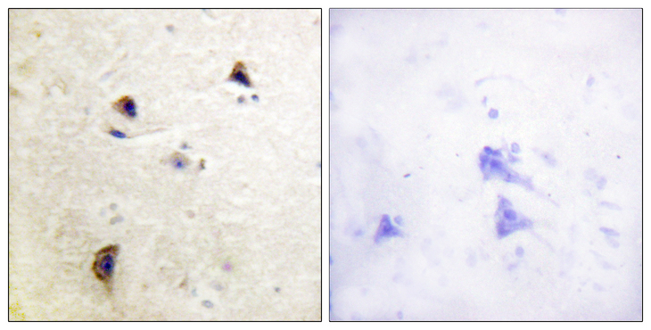 RPH3A / Rabphilin 3A Antibody - Immunohistochemistry analysis of paraffin-embedded human brain, using Rabphilin 3A (Phospho-Ser237) Antibody. The picture on the right is blocked with the phospho peptide.