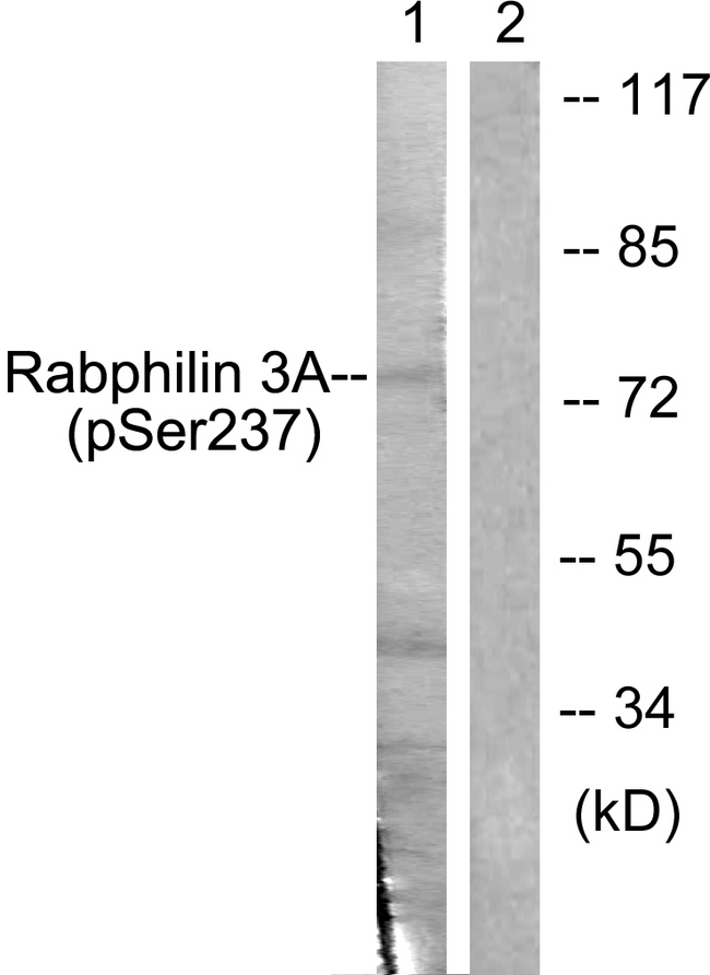 RPH3A / Rabphilin 3A Antibody - Western blot analysis of lysates from RAW264.7 cells treated with Calyculin 100nM 15', using Rabphilin 3A (Phospho-Ser237) Antibody. The lane on the right is blocked with the phospho peptide.