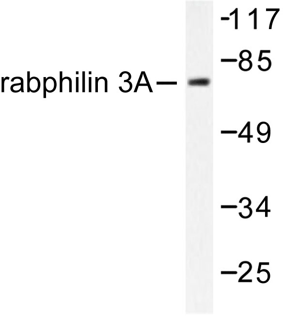 RPH3A / Rabphilin 3A Antibody - Western blot of Rabphilin 3A (P231) pAb in extracts from HeLa cells treated with TNF-a 20ng/ml 2'.