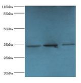 RPH3AL Antibody - Western blot. All lanes: Rab effector Noc2 antibody at 2 ug/ml Lane 1:rat liver tissue Lane 2: K562 whole cell lysate. Lane 3: A549 whole cell lysate. Secondary antibody: Goat polyclonal to rabbit at 1:10000 dilution.  This image was taken for the unconjugated form of this product. Other forms have not been tested.