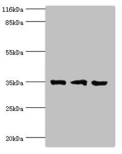 RPH3AL Antibody - Western blot All lanes: Rab effector Noc2 antibody at 2µg/ml Lane 1: Rat liver tissue Lane 2: K562 whole cell lysate Lane 3: A549 whole cell lysate Secondary Goat polyclonal to rabbit IgG at 1/10000 dilution Predicted band size: 35, 32 kDa Observed band size: 35 kDa