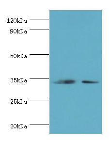 RPH3AL Antibody - Western blot. All lanes: RPH3AL antibody at 12 ug/ml. Lane 1: LO2 whole cell lysate. Lane 2: K562 whole cell lysate. Secondary antibody: Goat polyclonal to rabbit at 1:10000 dilution. Predicted band size: 34 kDa. Observed band size: 34 kDa.
