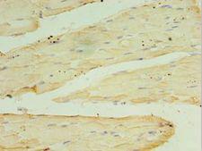 RPH3AL Antibody - Immunohistochemistry of paraffin-embedded human skeletal muscle using antibody at 1:100 dilution.