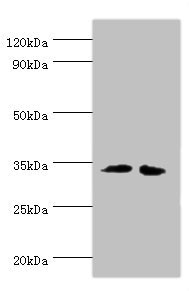 RPH3AL Antibody - Western blot All lanes: RPH3AL antibody at 12µg/ml Lane 1: LO2 whole cell lysate Lane 2: K562 whole cell lysate Secondary Goat polyclonal to rabbit IgG at 1/10000 dilution Predicted band size: 35, 32 kDa Observed band size: 35 kDa