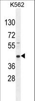 RPH3AL Antibody - RPH3AL Antibody western blot of K562 cell line lysates (35 ug/lane). The RPH3AL antibody detected the RPH3AL protein (arrow).