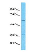 RPH3AL Antibody - Western blot of RPH3AL Antibody with 293T Whole Cell lysate.  This image was taken for the unconjugated form of this product. Other forms have not been tested.