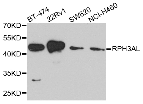 RPH3AL Antibody - Western blot analysis of extract of various cells.