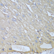 RPH3AL Antibody - Immunohistochemistry of paraffin-embedded human liver tissue.