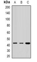 RPH3AL Antibody - Western blot analysis of Rabphilin-3AL expression in BT474 (A); 22RV1 (B); SW620 (C) whole cell lysates.