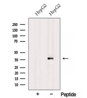 RPH3AL Antibody - Western blot analysis of extracts of HepG2 cells using RPH3AL antibody. The lane on the left was treated with blocking peptide.