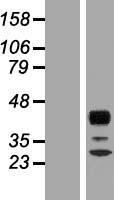 RPH3AL Protein - Western validation with an anti-DDK antibody * L: Control HEK293 lysate R: Over-expression lysate