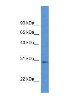 RPIA / RPI Antibody - RPIA antibody Western blot of Mouse Pancreas lysate. Antibody concentration 1 ug/ml.  This image was taken for the unconjugated form of this product. Other forms have not been tested.