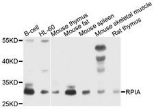 RPIA / RPI Antibody - Western blot analysis of extracts of various cells.