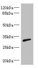 RPIA / RPI Antibody - Western blot All Lanes: RPIA antibody IgG at 3.29ug/ml+ Mouse kidney tissue Secondary Goat polyclonal to rabbit IgG at 1/10000 dilution Predicted band size: 33 kDa Observed band size: 33 kDa