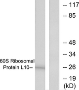 RPL10 / Ribosomal Protein L10 Antibody - Western blot analysis of lysates from K562 cells, treated with Insulin 0.01u/ml 15min, using 60S Ribosomal Protein L10 Antibody. The lane on the right is blocked with the synthesized peptide.