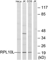 RPL10 / Ribosomal Protein L10 Antibody - Western blot analysis of lysates from Jurkat, COS7, and HeLa cells, using RPL10L Antibody. The lane on the right is blocked with the synthesized peptide.