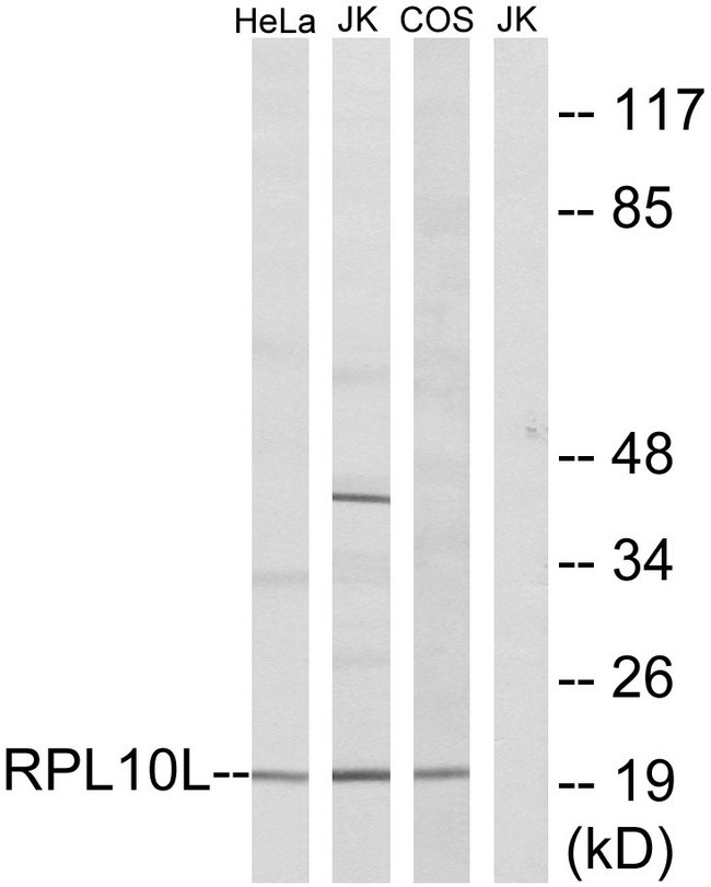 RPL10 / Ribosomal Protein L10 Antibody - Western blot analysis of lysates from Jurkat, COS7, and HeLa cells, using RPL10L Antibody. The lane on the right is blocked with the synthesized peptide.
