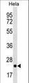 RPL10 / Ribosomal Protein L10 Antibody - RPL10 Antibody western blot of HeLa cell line lysates (35 ug/lane). The RPL10 antibody detected the RPL10 protein (arrow).