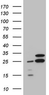 RPL10 / Ribosomal Protein L10 Antibody - HEK293T cells were transfected with the pCMV6-ENTRY control. (Left lane) or pCMV6-ENTRY RPL10. (Right lane) cDNA for 48 hrs and lysed. Equivalent amounts of cell lysates. (5 ug per lane) were separated by SDS-PAGE and immunoblotted with anti-RPL10. (1:2000)